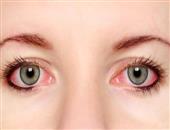眼睛充血是什么原因？究竟是什么原因会引起眼睛充血？