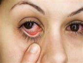 春季眼睛痒可能是结膜炎