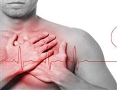 室性早搏提示心肌梗塞