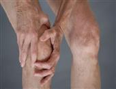 警惕膝关节炎来袭的六个信号