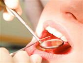 清除牙菌斑預防牙齦炎
