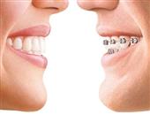 专家提醒乳牙龋齿将会影响儿童全身发育及发音
