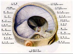 上矢状窦血栓性静脉炎