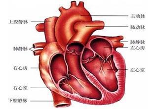 限制型心脏病