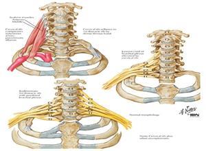 颈肋综合征