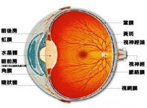 原发性视网膜脱离