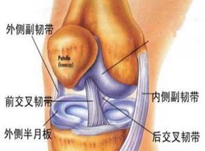 膝关节侧副韧带损伤