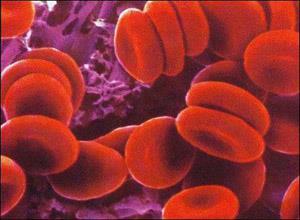 相对性红细胞增多症