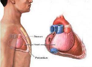 肺-胸膜阿米巴病