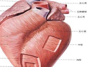 心室肌致密化不全