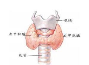 急性放射性甲状腺炎