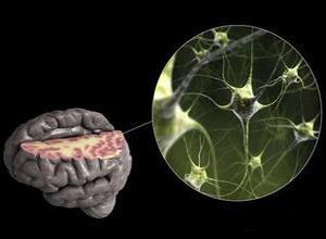 持续性植物状态