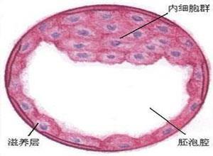 结核性阴道炎