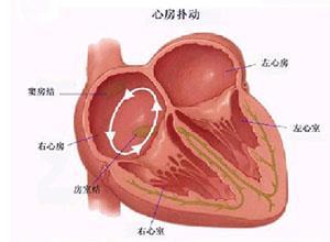 心房扑动与心房颤动