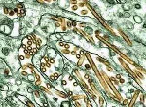 冷凝集素综合征