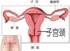 卵巢过度刺激综合征