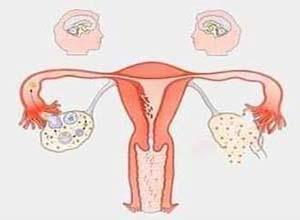 卵巢肌肉来源肿瘤