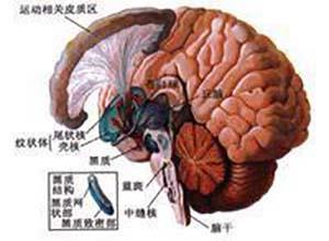 妊娠舞蹈病