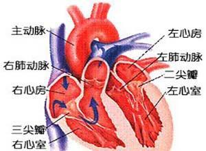 妊娠性心肌梗死