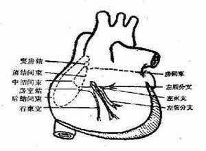 特发性心室颤动