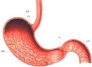 胃黏膜脱垂