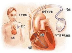 小儿窦性心动过速