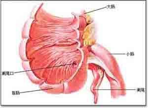 活动盲肠综合征