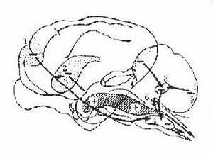 小儿新变异型克罗伊茨费尔特-雅各布病