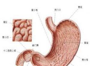 新生儿胃穿孔