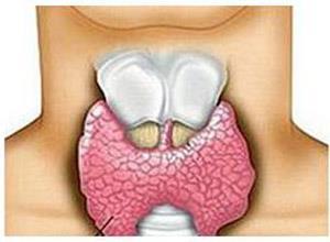 亚临床型克汀病