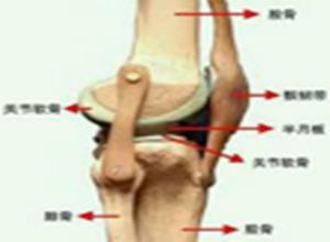 增生性骨关节病