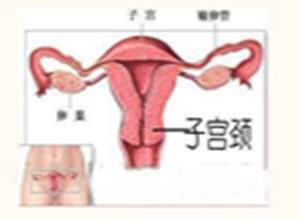 间质膀胱炎局限外阴炎和脱屑性阴道炎综合征