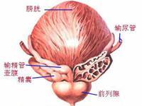 特异性前列腺炎