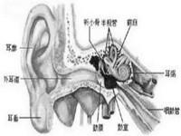 创伤性耳聋