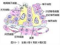 精原细胞瘤