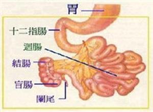 小肠吸收不良综合征