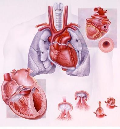完全性大动脉转位