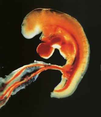 懷孕第八個月時胎兒的發育
