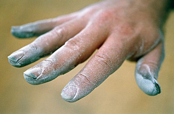 摆脱灰指甲的纠缠须选择个性化治疗方案