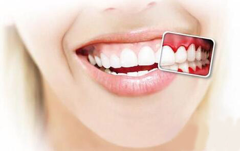 口腔牙齿健康必需得刷牙