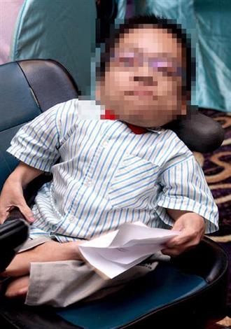 女儿的骨头为何如此脆弱？