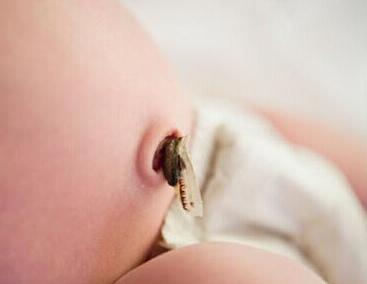 新生儿脐带脱落前可使用婴儿护脐贴保持干燥