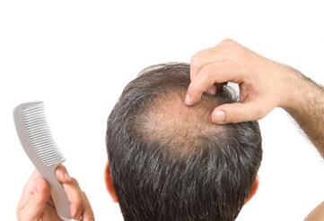 如何预防青年期脱发及早秃