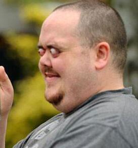 二十年临床验证，甲亢突眼治疗新曙光