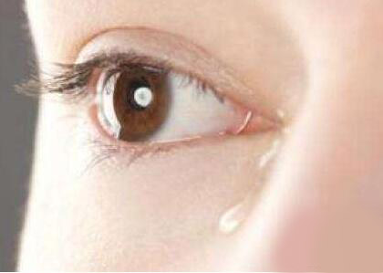 经常泪汪汪小心泪囊炎滥用眼药水造成泪囊炎
