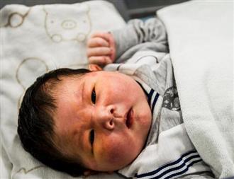 广东孕妇产下14斤重巨婴
