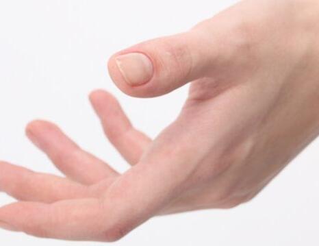 女性手部湿疹如何有效护理？