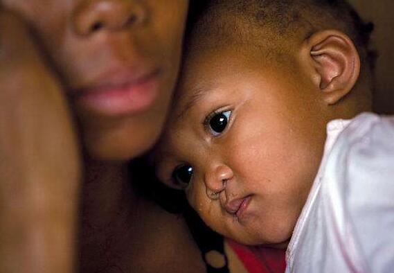 预防艾滋病通过母婴传播