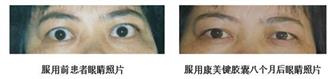 免疫调节剂的春天——康美键