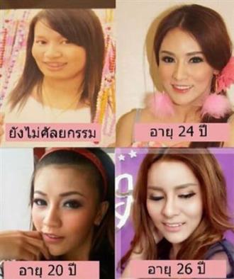 泰国女神诺克Nokky韩国整形，丑泰妹整形变身白富